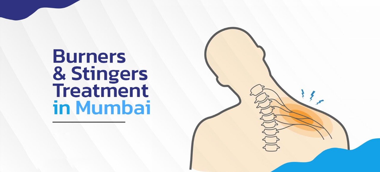 Burners and stingers treatment Mumbai