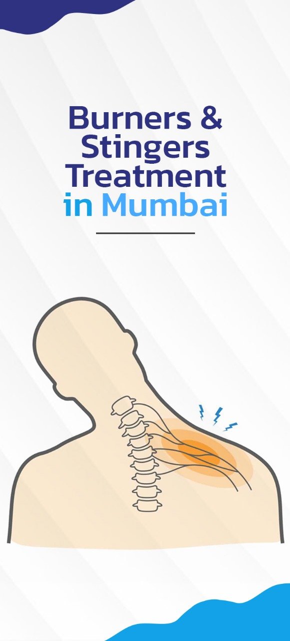 Burners and stingers treatment Mumbai