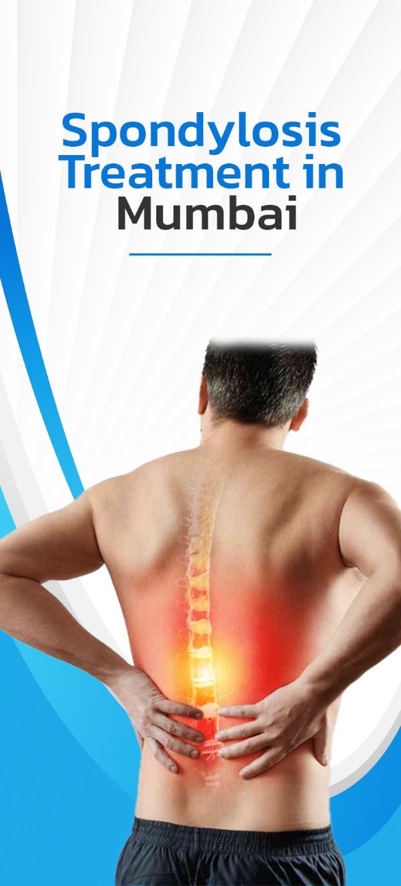 Spondylosis Treatment Mumbai