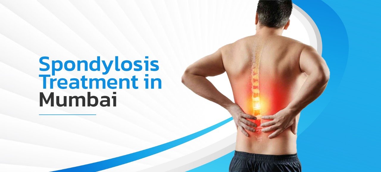 Spondylosis Treatment in Mumbai