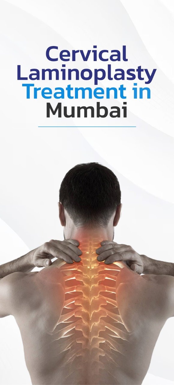 Cervical Laminoplasty Treatment Mumbai