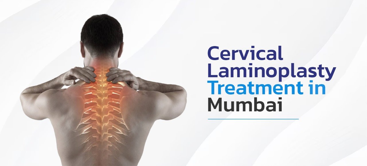 Cervical Laminoplasty Treatment in Mumbai