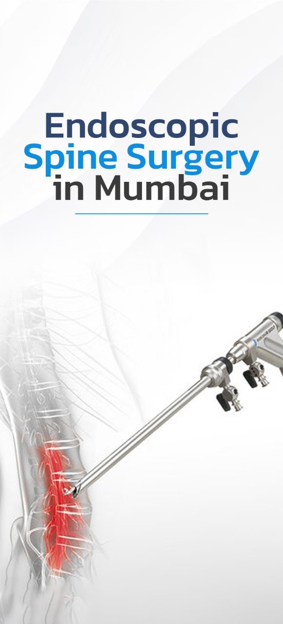 Endoscopic Spine Surgery Mumbai