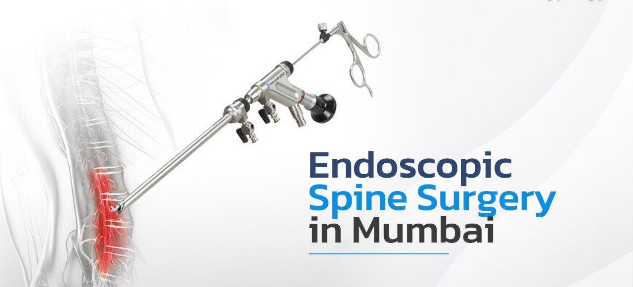 Endoscopic Spine Surgery in Mumbai