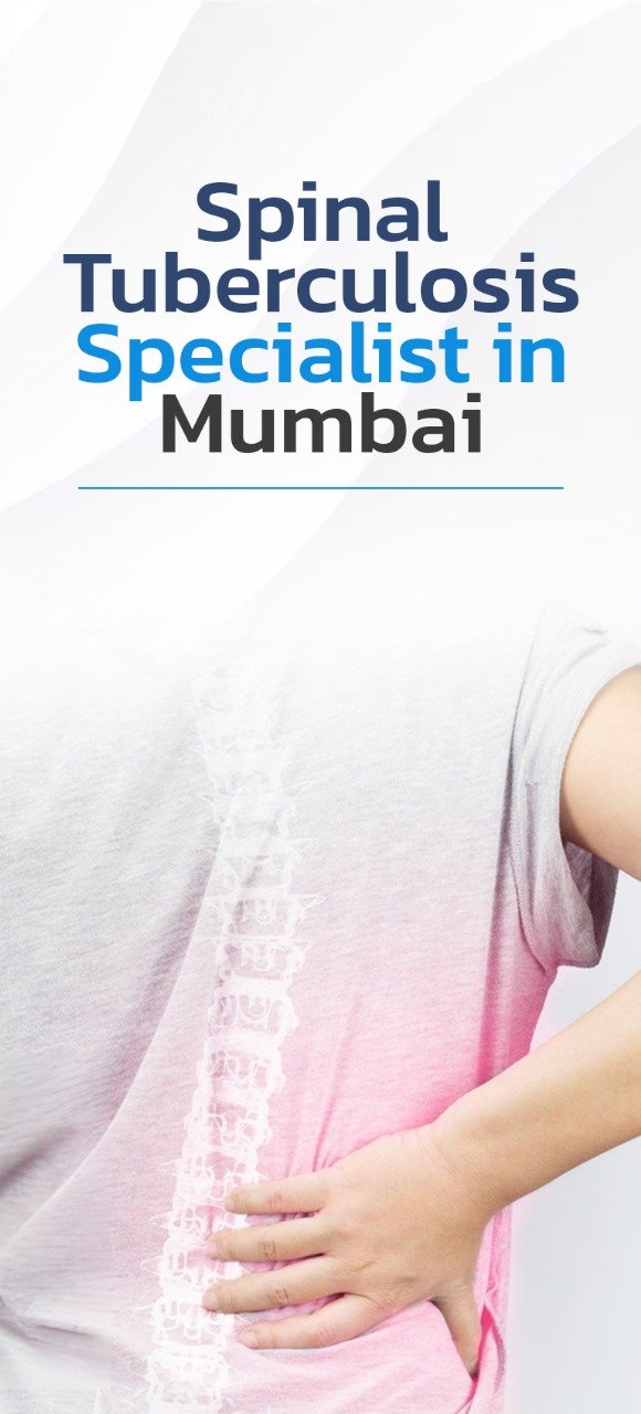 Spinal Tuberculosis Treatment in Mumbai