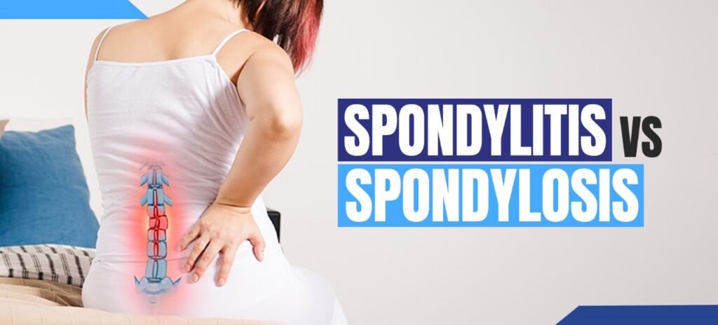 Spondylosis vs Spondylitis Dr Priyank Patel