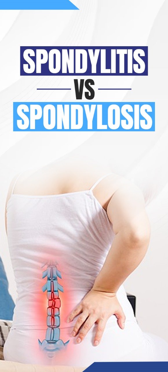 Spondylosis vs Spondylitis Dr Priyank