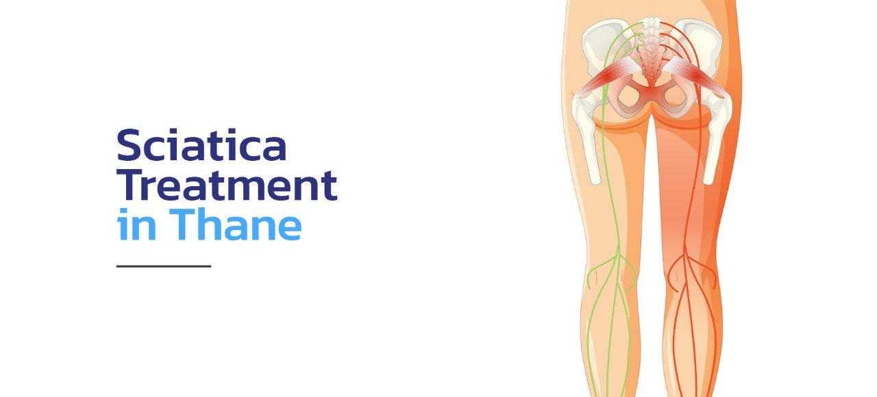sciatica treatment in Thane